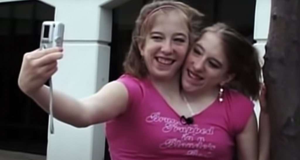 Abby et Brittany Hensel : des jumelles siamoises qui ont acquis une renommée internationale