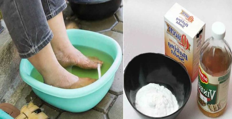 Le Remède Magique Contre Les Mycoses Des Pieds - Remèdes Naturels