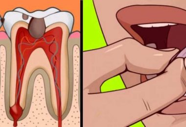 Les 10 remèdes de grand-mères contre le mal de dents