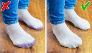 How to remove shoe marks from feet and socks?