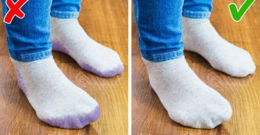 How to remove shoe marks from feet and socks?