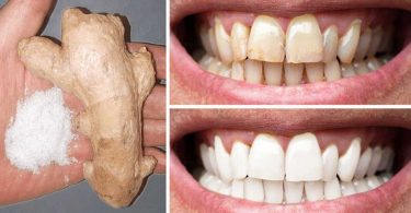 Le gingembre et le sel permettent de blanchir les dents : voici comment les utiliser