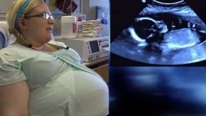 Une mère donne naissance à des quadruplés après un accouchement difficile
