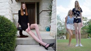 Une adolescente de 17 ans a les plus longues jambes du monde