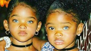 Ces jolies jumelles à peau noire et yeux bleus avaient suscité l'admiration de milliers d'internautes il y a 8 ans, les revoilà à nouveau aujourd'hui !