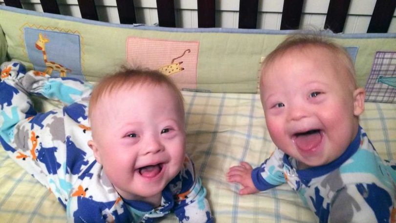 Les jumeaux les plus exceptionnels : une mère de 45 ans est heureuse d'avoir fait le meilleur choix