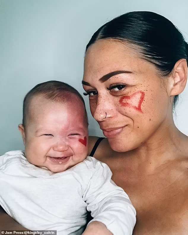 Des trolls cruels accusent une mère d'être un "monstre" pour avoir fait disparaître au laser la tache de vin sur le visage de son bébé - mais elle affirme que "c'est loin d'être ce qu'ils pensent".