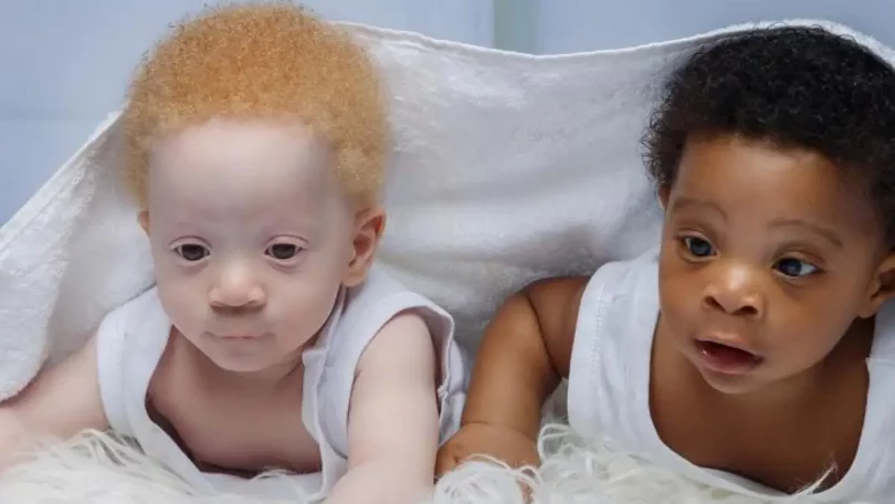 Maman De Jumeaux Noir Et Blanc Souvent Questionnée Sur Lequel Des Garçons Est À Elle