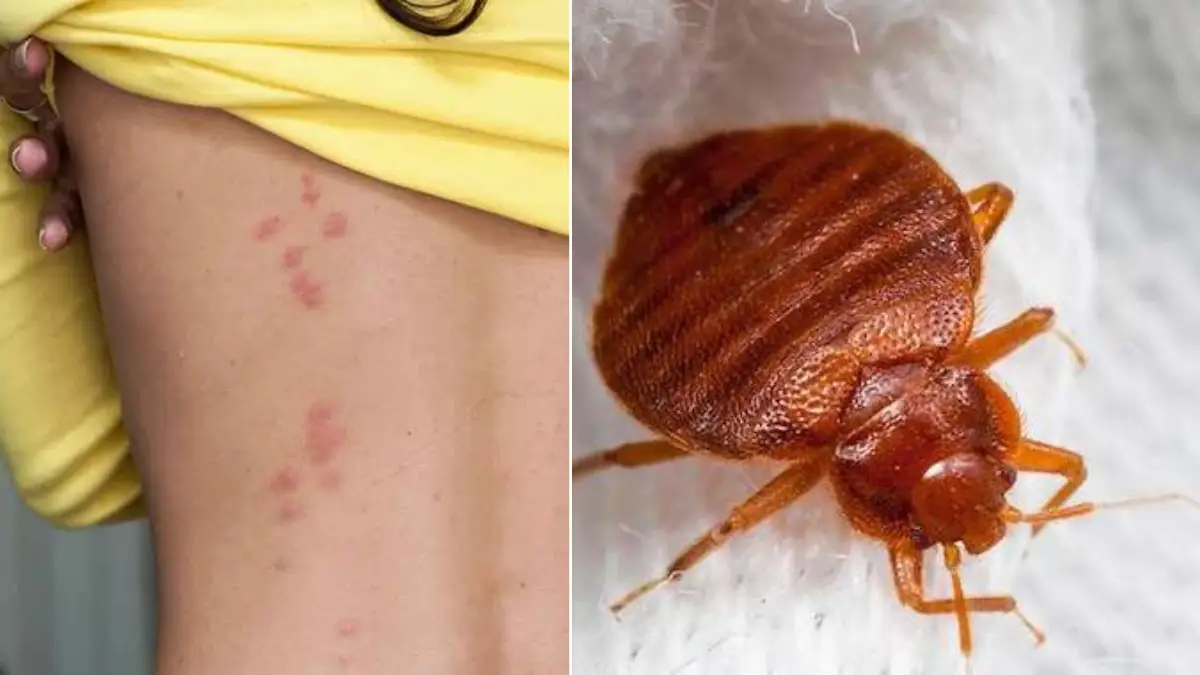 4 astuces pour éliminer les punaises de la maison