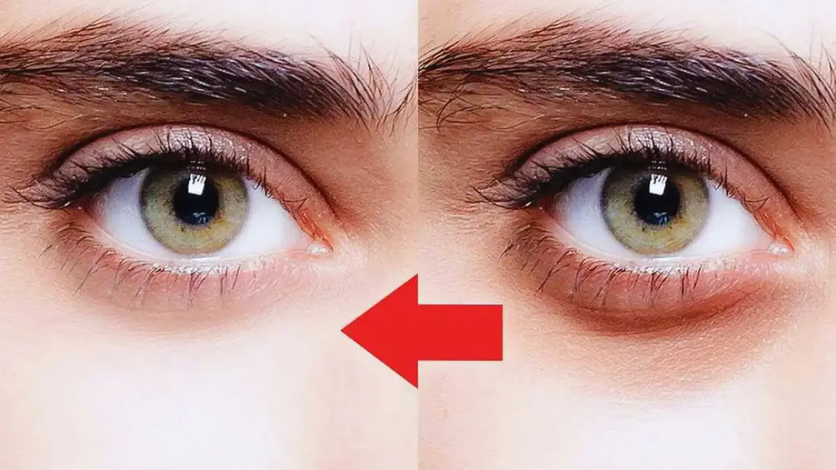 Appliquez ce mélange sur votre visage pendant 15 minutes pour effacer les cernes et les poches